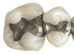Amalgam Amalgam